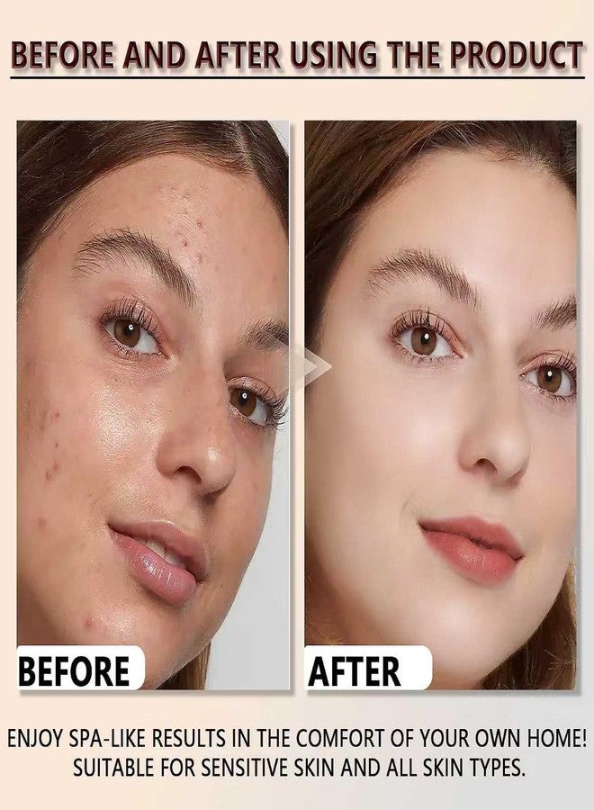 Loobexery 2PCS Rice Exfoliating Ampoule Set, Black & White Rice Peel Shot Glow Rice Ampoule Duo, Gentle Peel + Pore Minimizing & Deep Hydration for All Skin Types - Image 4